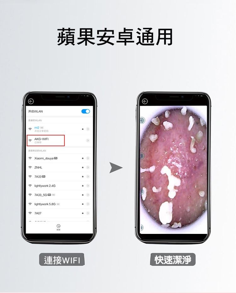 蘋果安卓通用，开WLAN，• Xaomi_douya a，• TA33，連接WIFI，快速潔淨。
