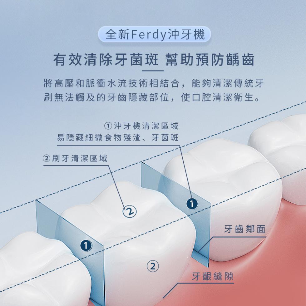 全新Ferdy沖牙機，有效清除牙菌斑 幫助預防齲齒，將高壓和脈衝水流技術相結合,能夠清潔傳統牙，刷無法觸及的牙齒隱藏部位,使口腔清潔衛生。①沖牙機清潔區域，易隱藏細微食物殘渣、牙菌斑，牙齒鄰面，②刷牙清潔區域，牙齦縫隙。